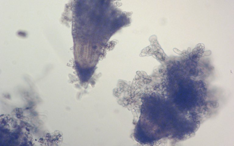 Drogi otrzymywania roślin in vitro: organogeneza